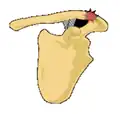 Classification type 1 is the most common type