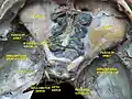 Ethmoid sinus. Ethmoidal air cells. Deep dissection. Superior view.