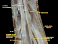 Spinal cord. Spinal membranes and nerve roots. Deep dissection. Posterior view.